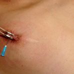Second pic of Amateur Needle Pain