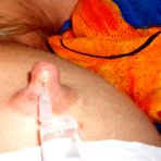 Fourth pic of Saline Injection