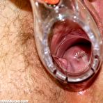 Fourth pic of Libuse elder old nurse twat masturbation at gyno clinic with speculum and plastic cock