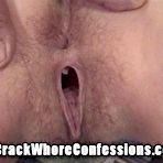 Third pic of Drug Addict Crack Whore Prostitute Pictures Hardcore Reality Porn