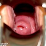 Third pic of Candie gyno chair pussy speculum exam at  gynecology practice by deviated physician