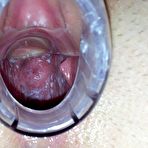 Fourth pic of Natalie gyno pussy vaginal speculum visit at mad gynoclinic with mature puss doctor