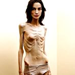 Ultra skinny nude girls-naked photo