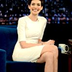 Second pic of Anne Hathaway shows her legs at Late Night