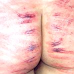 Third pic of EXTRA PAIN - PAINFUL TORTURE PHOTOS!