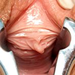 Third pic of Jessica bizzare pussy speculum gyno exam by old doctor