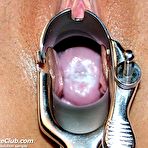 Third pic of Sara extreme pussy speculum gaping at gynecology room by skilled practitioner