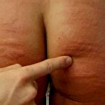 Fourth pic of Brutal Whipping, Spanking, Corporal Punishment, Flogging, BDSM, and Suspension