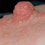 Second pic of Real Huge Nipples