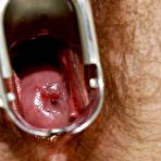 Third pic of Karin  senior lousy nurse hole plastic penis masturbation on gynochair