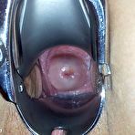 Fourth pic of Scarlet  very kinky gyno puss speculum checkup