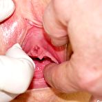 Second pic of Blonde Kristyna gyno pussy speculum exam at kinky gyno clinic