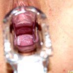 Third pic of Camilla gyno pussy speculum checkup at kinky bizzare gynoclinic