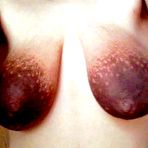 First pic of Real Huge Nipples