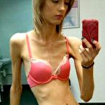 Third pic of Anorexic Selfies (10 pics)