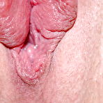 Second pic of Pumped pussy lips - 16 Pics | xHamster