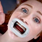 Fourth pic of The Dentist Vol 3 E3 | PurgatoryX